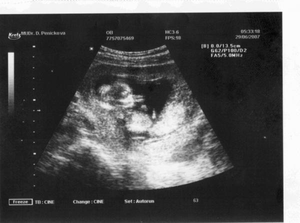 malé Kaplisátko...